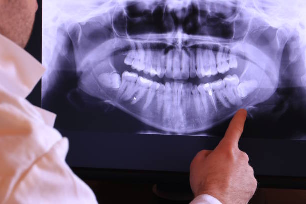 Best Emergency Cosmetic Dentistry in Blue Bell, PA