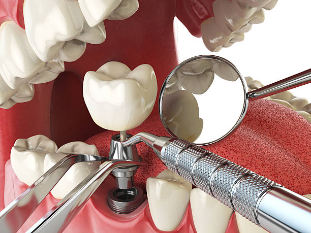 Best Emergency Dental Services for Seniors in Blue Bell, PA